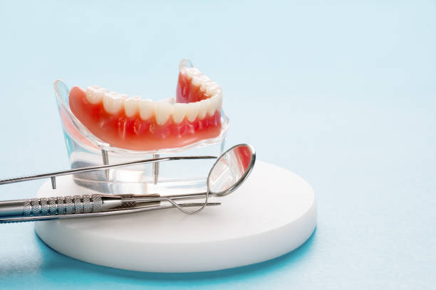 Dental Inlays and Onlays in Janesville, IA